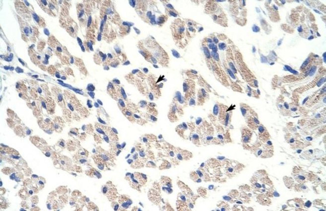 Aconitase 1 Antibody in Immunohistochemistry (Paraffin) (IHC (P))