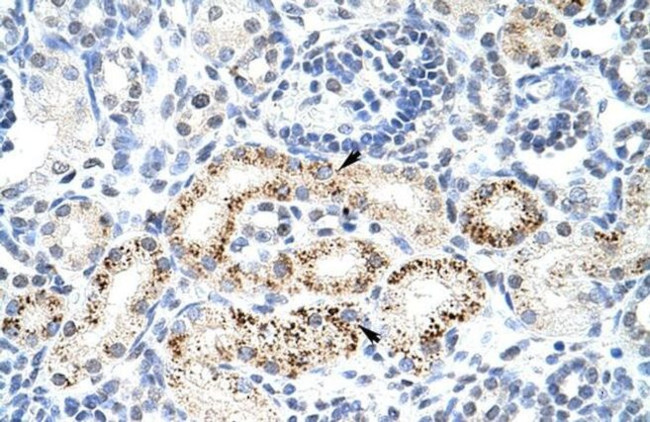 PPP1R8 Antibody in Immunohistochemistry (Paraffin) (IHC (P))