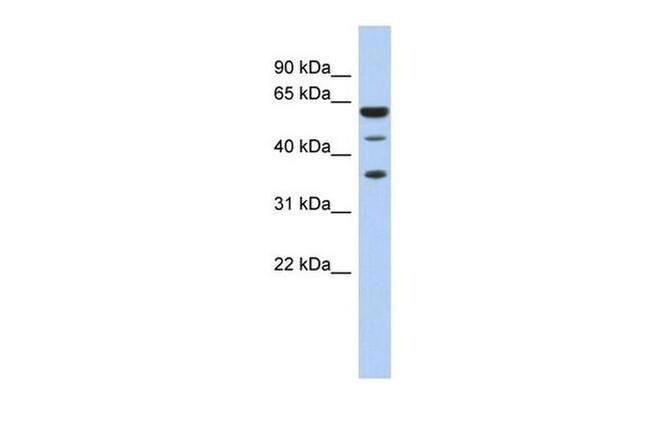 RDBP Antibody in Western Blot (WB)