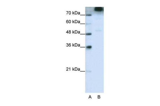 eIF3b Antibody in Western Blot (WB)