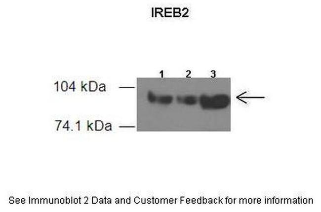 IREB2 Antibody in Western Blot (WB)