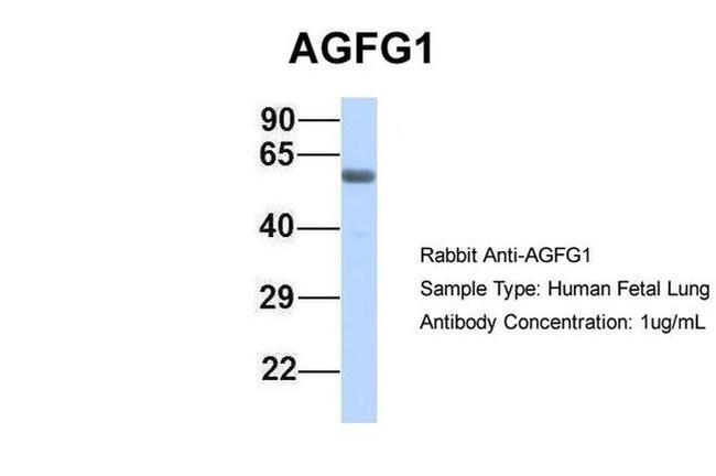 AGFG1 Antibody in Western Blot (WB)