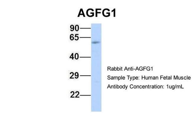 AGFG1 Antibody in Western Blot (WB)