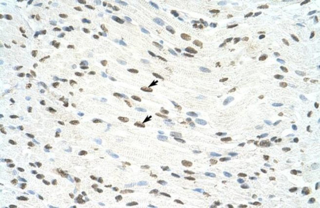 ILF3 Antibody in Immunohistochemistry (Paraffin) (IHC (P))