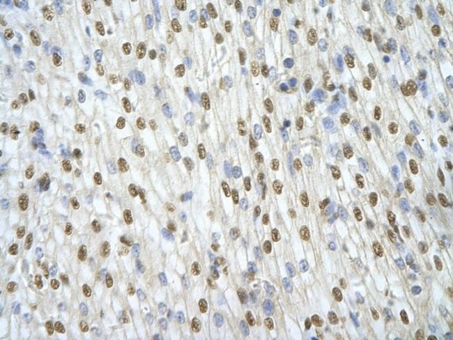 ILF3 Antibody in Immunohistochemistry (Paraffin) (IHC (P))