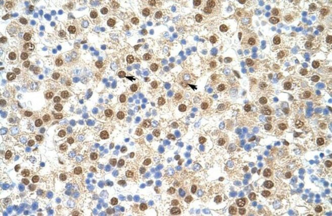 ILF3 Antibody in Immunohistochemistry (Paraffin) (IHC (P))