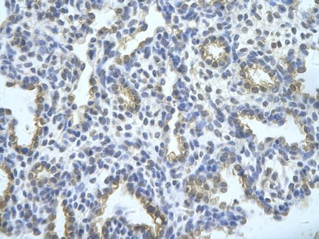 SFRS10 Antibody in Immunohistochemistry (Paraffin) (IHC (P))