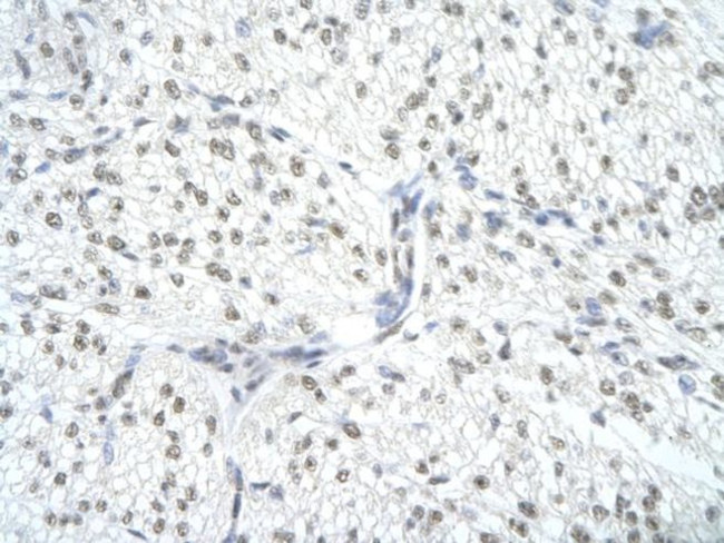 SNRPA Antibody in Immunohistochemistry (Paraffin) (IHC (P))