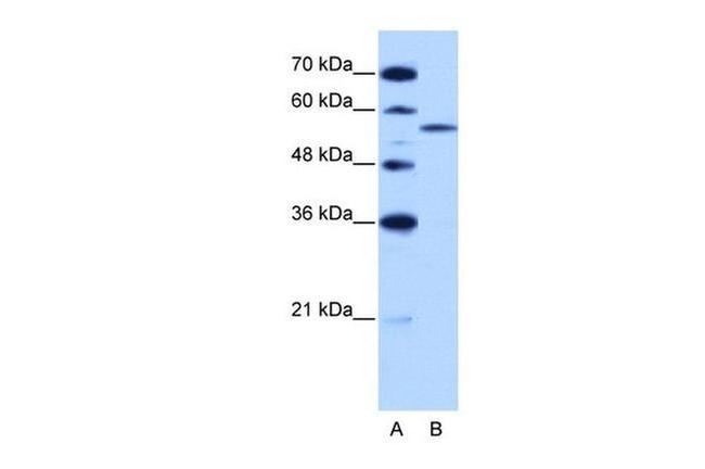 ZRSR2 Antibody in Western Blot (WB)