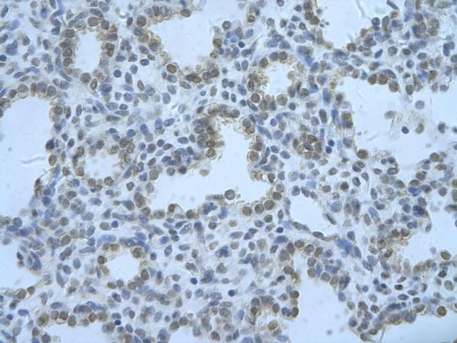 RBM8A Antibody in Immunohistochemistry (Paraffin) (IHC (P))