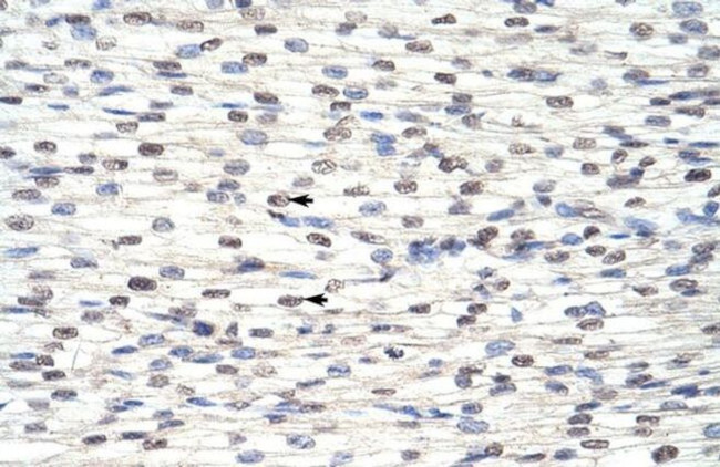 RBM8A Antibody in Immunohistochemistry (Paraffin) (IHC (P))