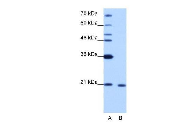 RBM8A Antibody in Western Blot (WB)