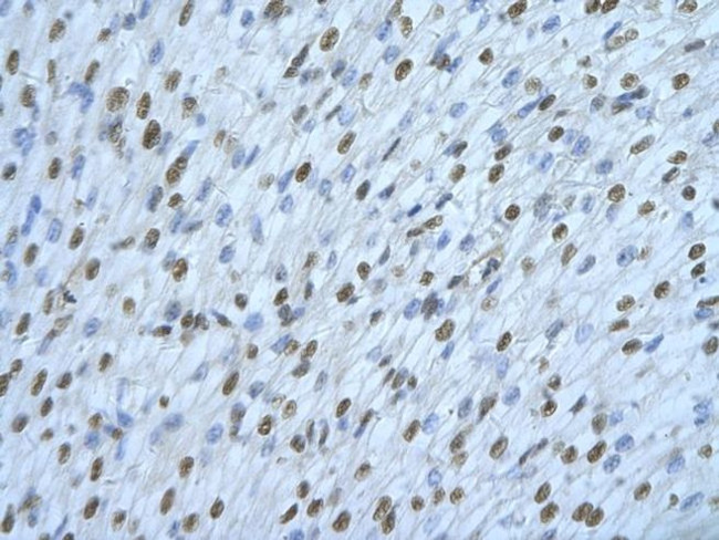 hnRNP DL Antibody in Immunohistochemistry (Paraffin) (IHC (P))