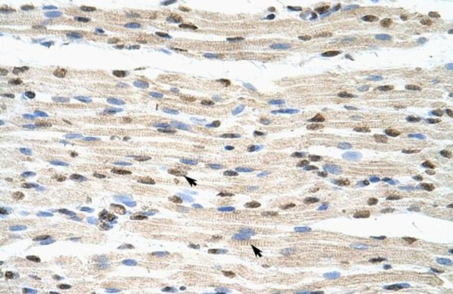 hnRNP DL Antibody in Immunohistochemistry (Paraffin) (IHC (P))