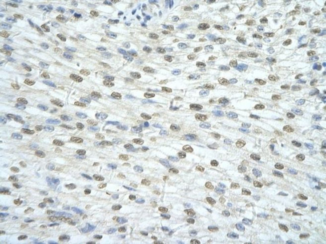 SF3A1 Antibody in Immunohistochemistry (Paraffin) (IHC (P))