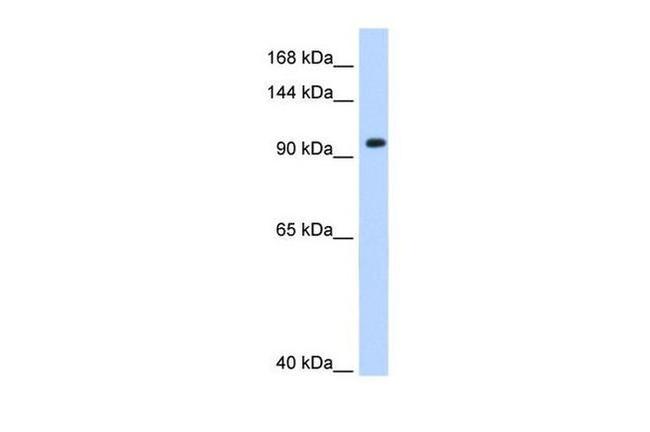 SF3A1 Antibody in Western Blot (WB)