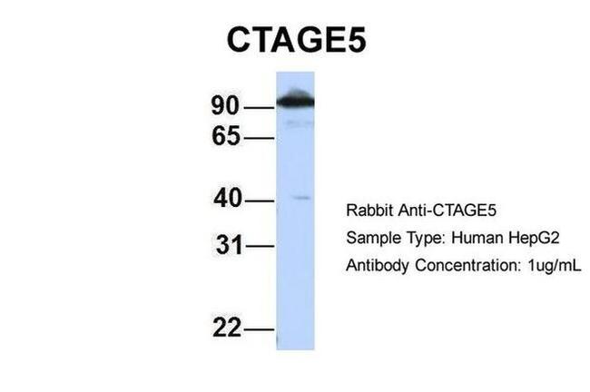 CTAGE5 Antibody in Western Blot (WB)