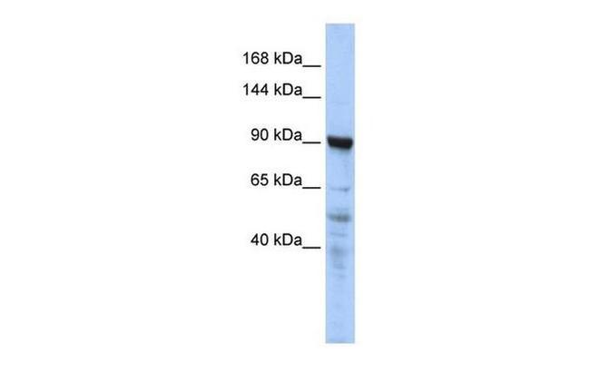 CTAGE5 Antibody in Western Blot (WB)