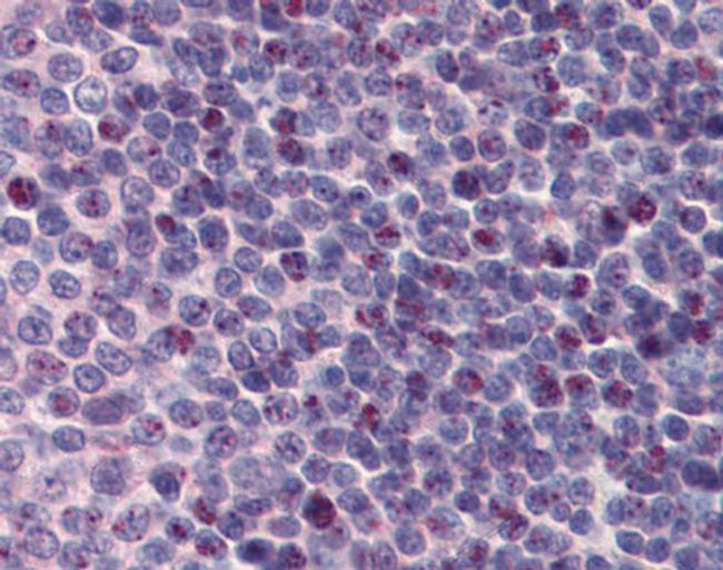 PCBP1 Antibody in Immunohistochemistry (Paraffin) (IHC (P))