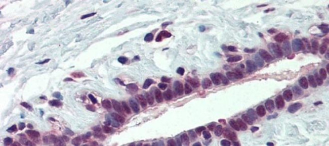 PCBP1 Antibody in Immunohistochemistry (Paraffin) (IHC (P))