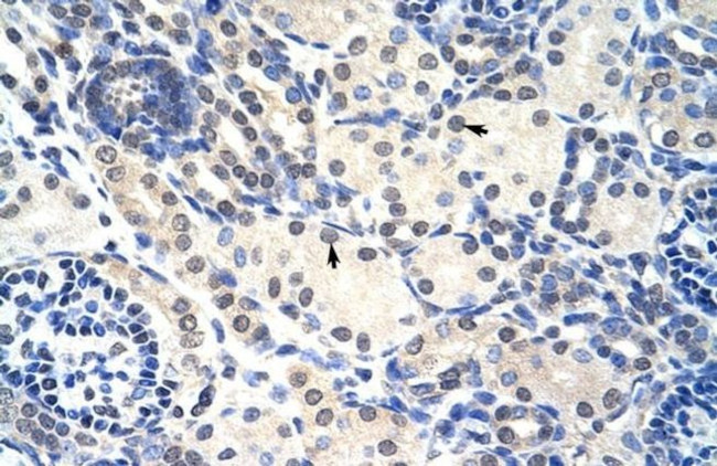 RNAse H2A Antibody in Immunohistochemistry (Paraffin) (IHC (P))