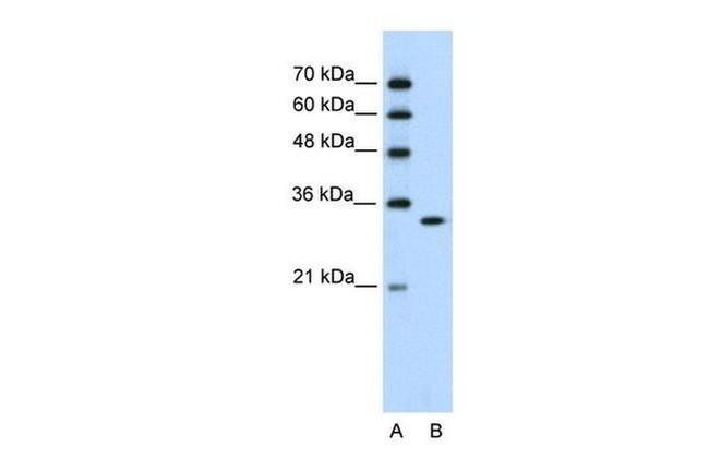 RNAse H2A Antibody in Western Blot (WB)