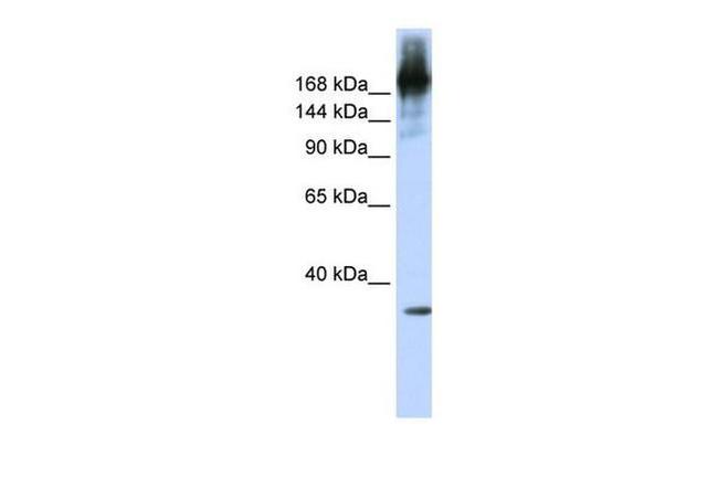 PRP8 Antibody in Western Blot (WB)