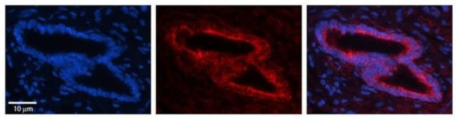 SLBP Antibody in Immunohistochemistry (Paraffin) (IHC (P))