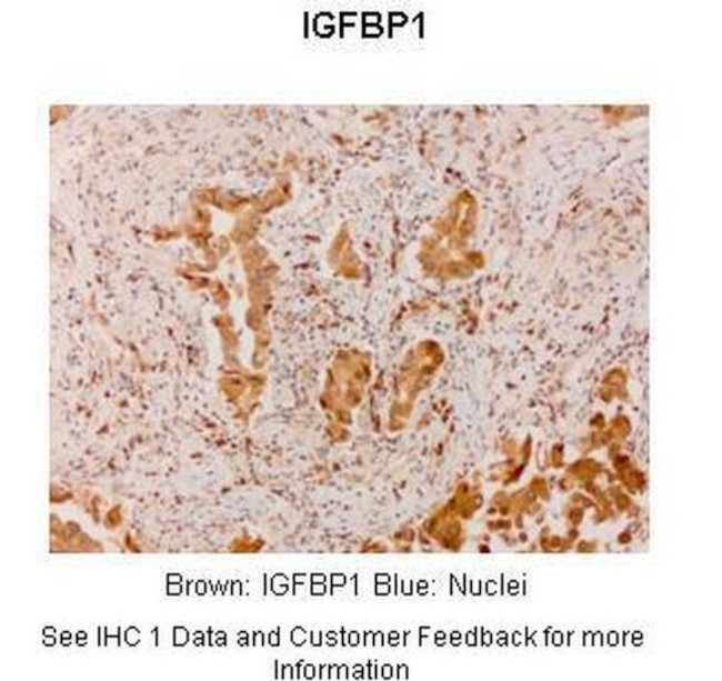 IGF2BP1 Antibody in Immunohistochemistry (IHC)