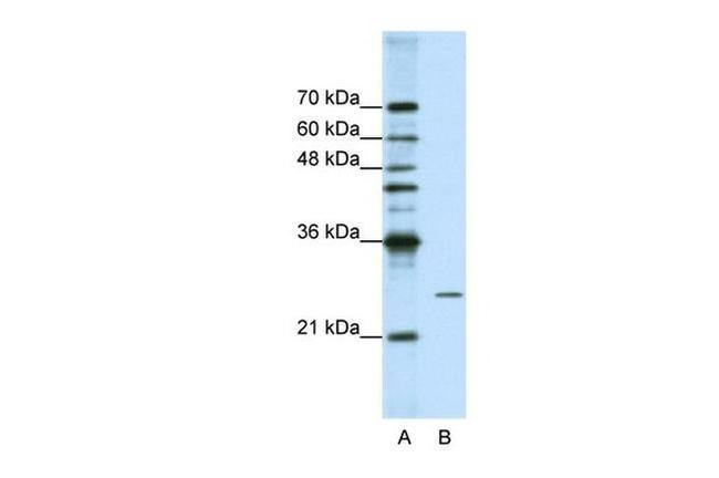 POP4 Antibody in Western Blot (WB)