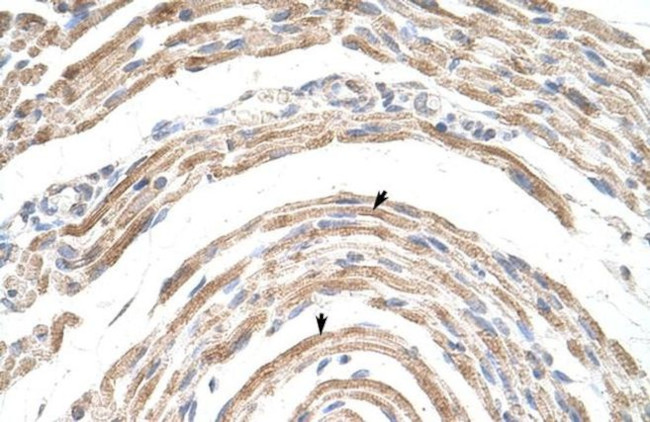 CPSF6 Antibody in Immunohistochemistry (Paraffin) (IHC (P))