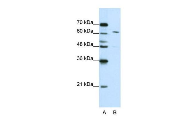 CPSF6 Antibody in Western Blot (WB)