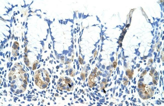 ADAT1 Antibody in Immunohistochemistry (Paraffin) (IHC (P))