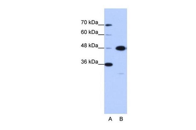 GTPBP9 Antibody in Western Blot (WB)