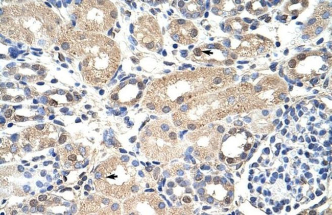 EXOSC7 Antibody in Immunohistochemistry (Paraffin) (IHC (P))