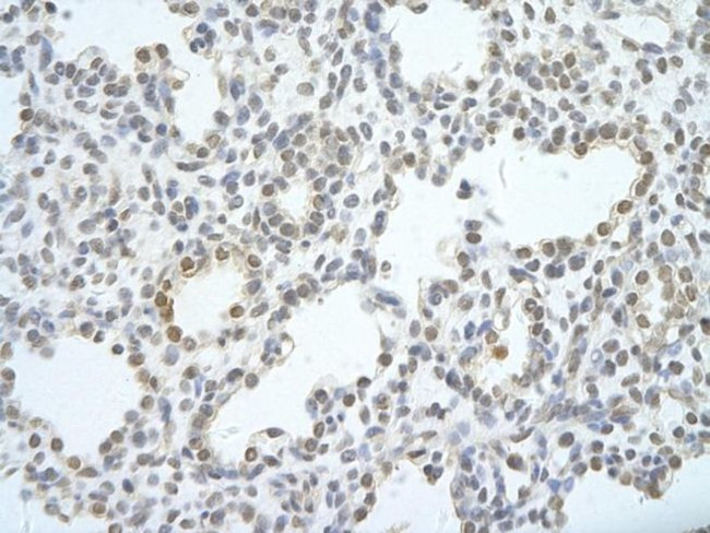 UTP18 Antibody in Immunohistochemistry (Paraffin) (IHC (P))