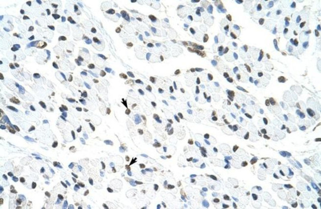 MATR3 Antibody in Immunohistochemistry (Paraffin) (IHC (P))