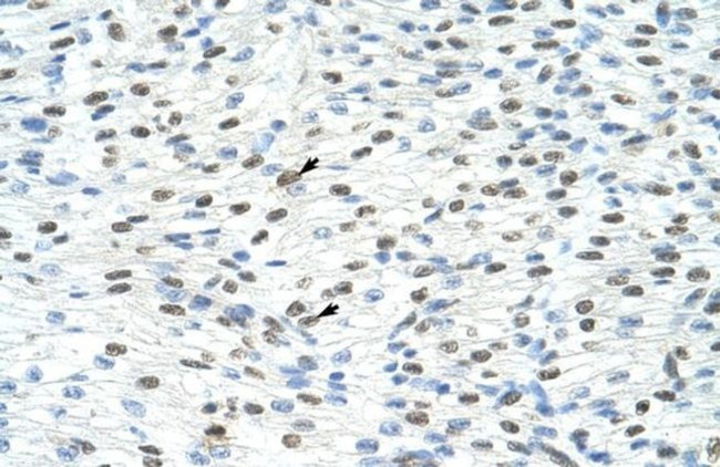 MATR3 Antibody in Immunohistochemistry (Paraffin) (IHC (P))