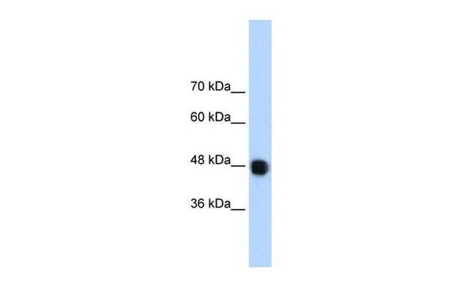 DAZAP1 Antibody in Western Blot (WB)