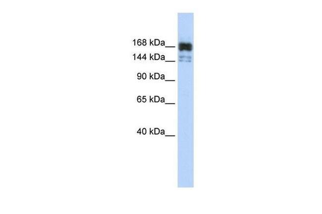 XRN1 Antibody in Western Blot (WB)