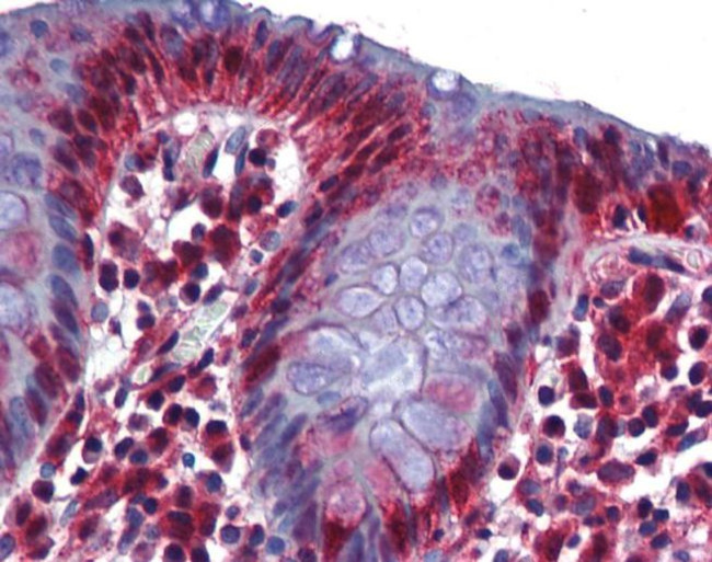 RBM47 Antibody in Immunohistochemistry (IHC)