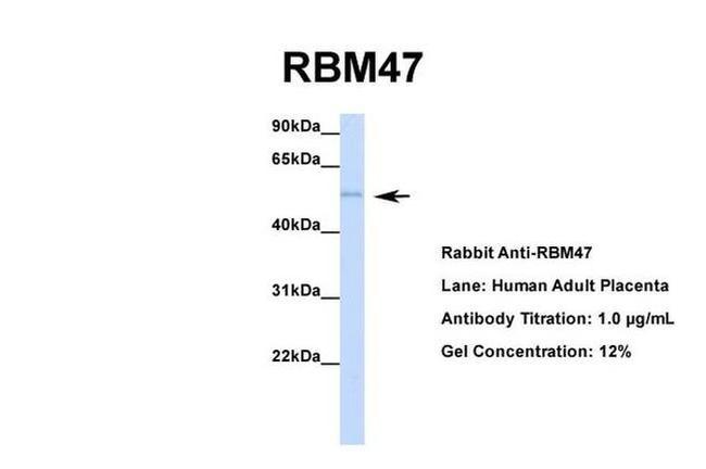 RBM47 Antibody in Western Blot (WB)