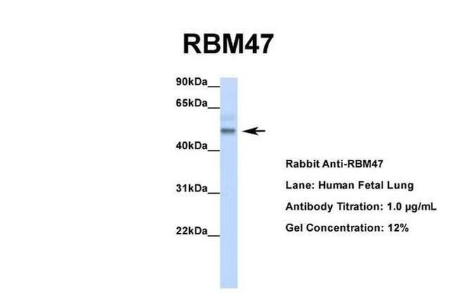 RBM47 Antibody in Western Blot (WB)