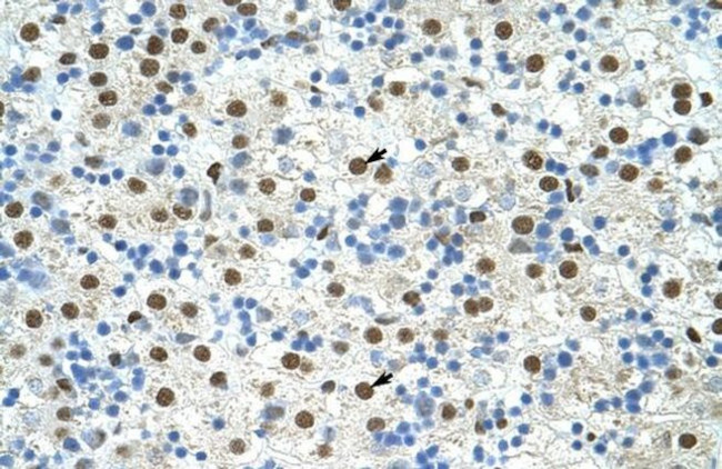 EXOSC4 Antibody in Immunohistochemistry (Paraffin) (IHC (P))