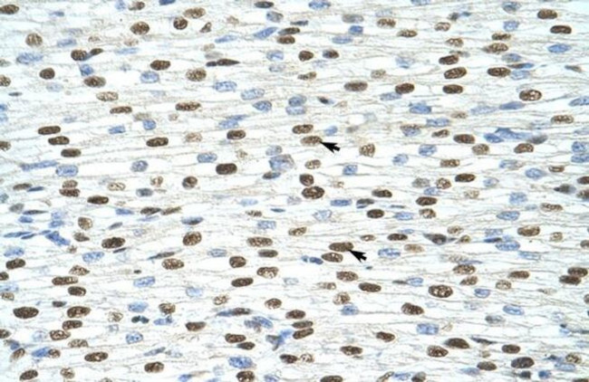 EXOSC4 Antibody in Immunohistochemistry (Paraffin) (IHC (P))