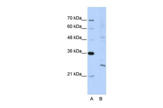 EXOSC4 Antibody in Western Blot (WB)