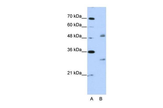 eIF4H Antibody in Western Blot (WB)