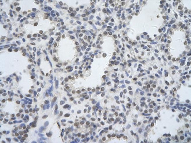 DDX17 Antibody in Immunohistochemistry (Paraffin) (IHC (P))