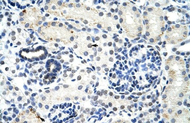 DDX17 Antibody in Immunohistochemistry (Paraffin) (IHC (P))