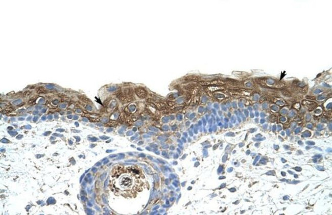 EIF2A Antibody in Immunohistochemistry (Paraffin) (IHC (P))